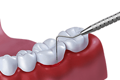 Ergo Zab Zae Zbb Zbe Ergo Zahnzusatzversicherung Zahnzusatzversicherung Vergleich Zahnzusatzversicherung Direkt